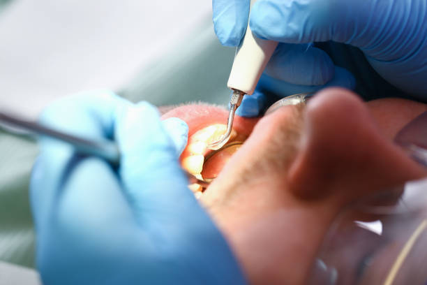 Best Dentist for Tooth Abscess  in Verona, WI