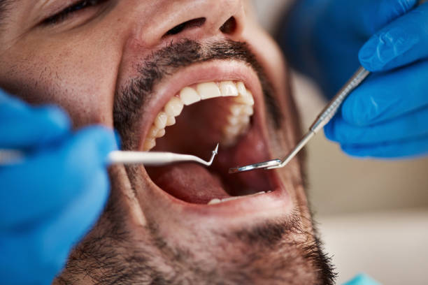 Best Tooth Infection Emergency Dentist  in Verona, WI